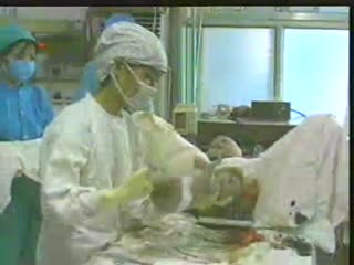稀有资源✅科普性教育卫生部研究内部资料✅真人示范,男女生殖健康科普,国语中字第01集